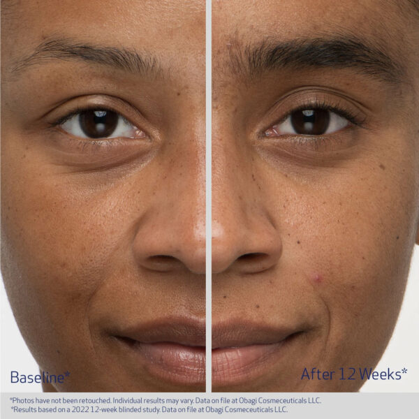 Obagi Nu-Cil™ Eyebrow Boosting Serum - Image 4
