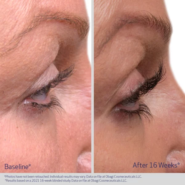 Obagi Nu-Cil™ Eyelash Enhancing Serum - Image 4