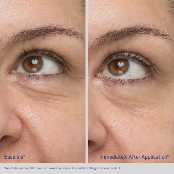 Obagi Daily Hydro-Drops® Rejuvenating Eye Gel Cream - Image 4