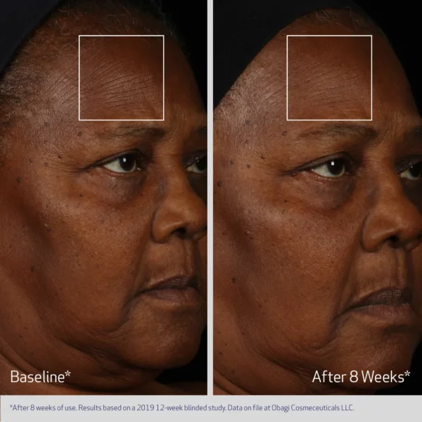 Obagi ELASTIderm® Facial Serum - Image 4