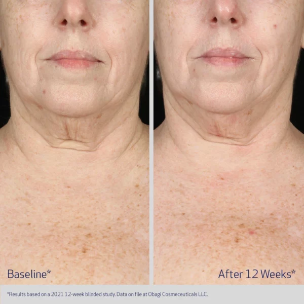 Obagi ELASTIderm® Neck and Decollete Concentrate - Image 4