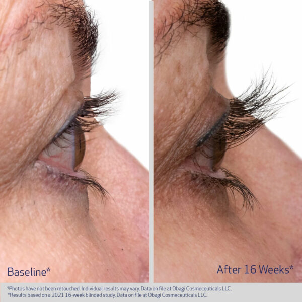 Obagi Nu-Cil™ Eyelash Enhancing Serum - Image 5