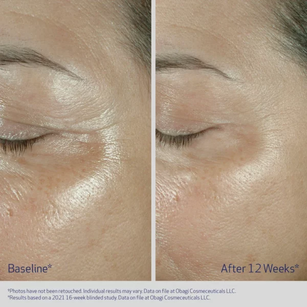 Obagi ELASTIderm® Eye Serum - Image 5