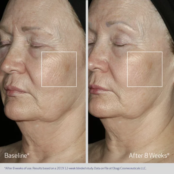 Obagi ELASTIderm® Facial Serum - Image 5