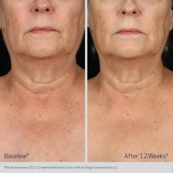 Obagi ELASTIderm® Neck and Decollete Concentrate - Image 5