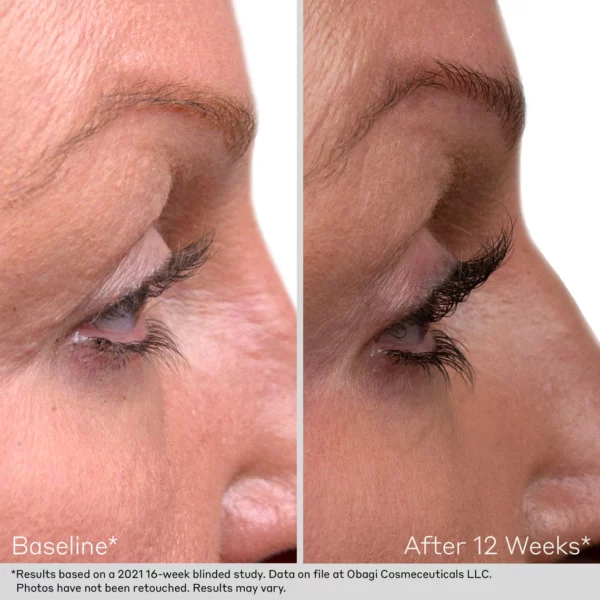 Obagi Nu-Cil™ Lash & Brow Serum Set - Image 2