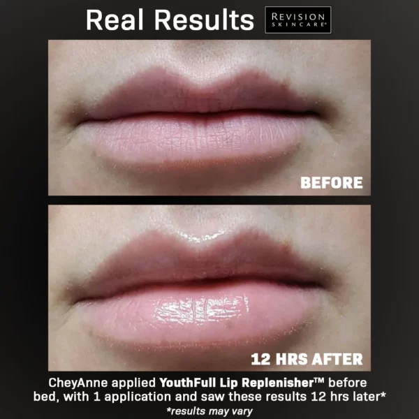Youthfull Lip Replenisher - Image 2